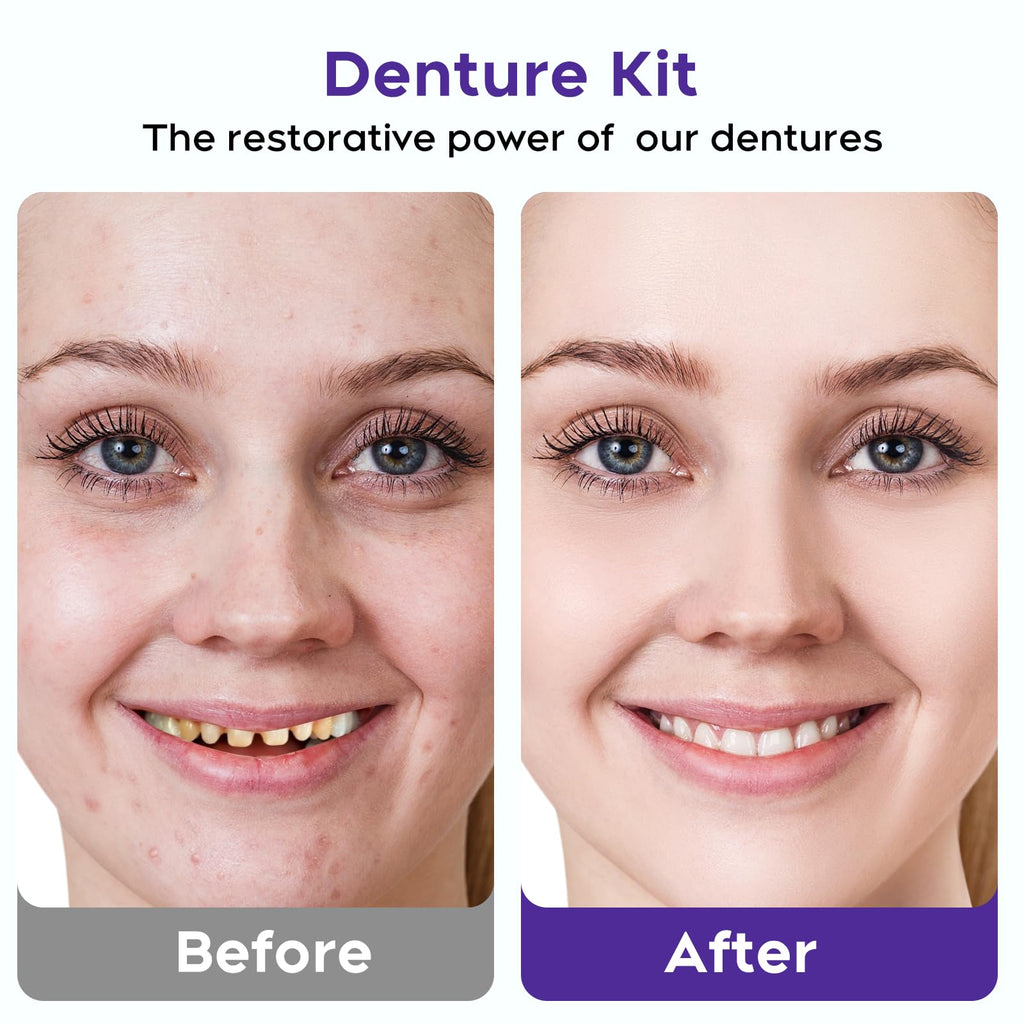 DIY Denture Kit for Upper & Lower Teeth S376
